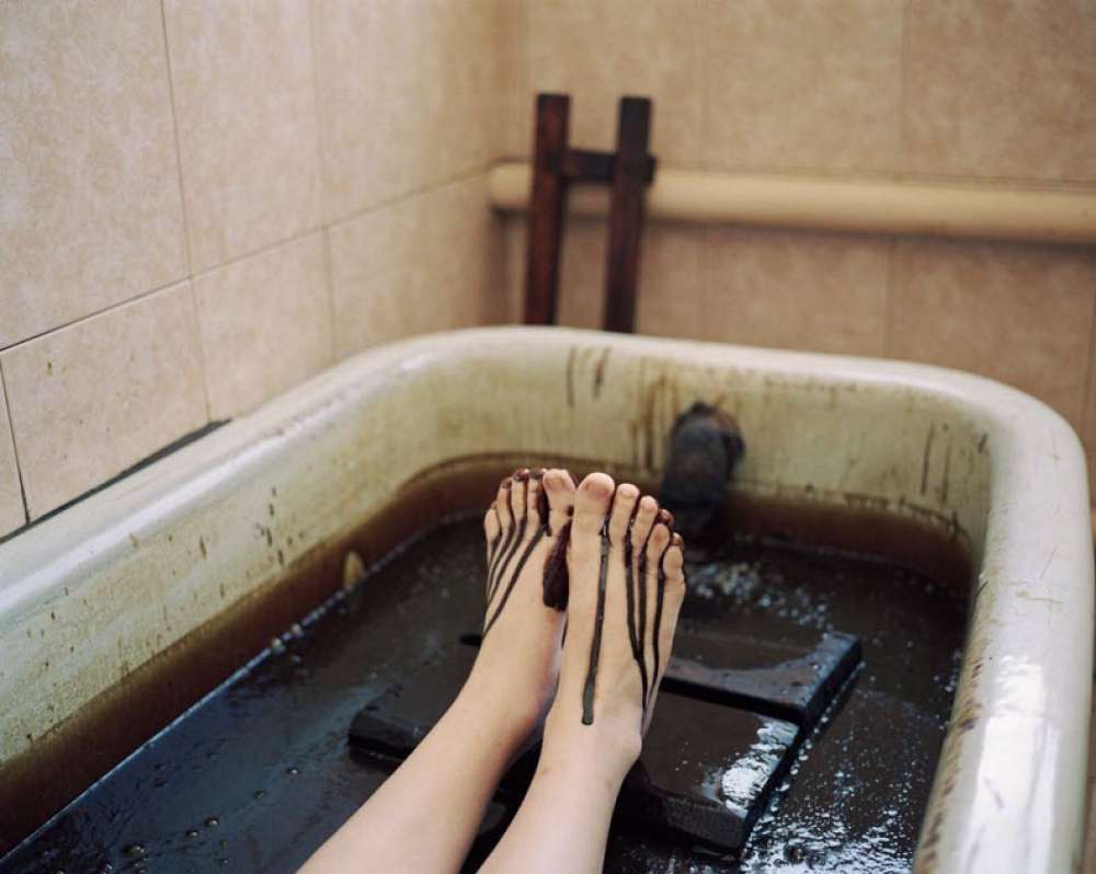 Medical Treatment Package at Naftalan - 11 Nights